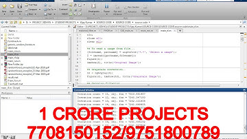 Microaneurysm Detection With Random Forest classification Using Matlab-1Crore Projects