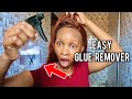 HOW TO REMOVE LACE FRONT GLUE IN 2 MINUTES