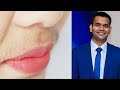 Facial Hair Treatment At Home | Facial Hair Removal Naturally | Dr Vivek Joshi