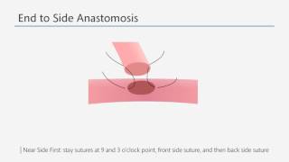 삼성서울병원 Advanced training on microsurgery 2[Micro] screenshot 3