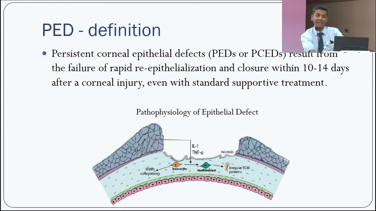 Avanta Meaning In English Avanta Meaning In English