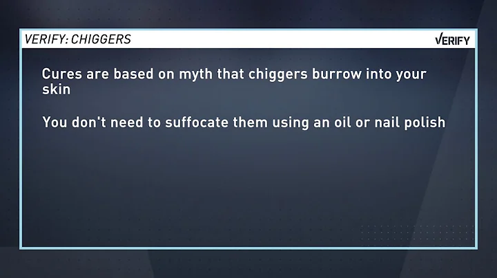 VERIFY: Should you treat chiggers with butter?