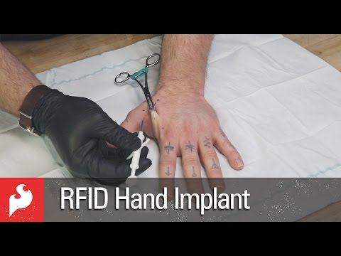 ‘Biohacker’ Implants Nick in Arm