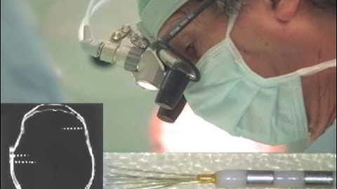 Regional Sleep Oscillations in Humans