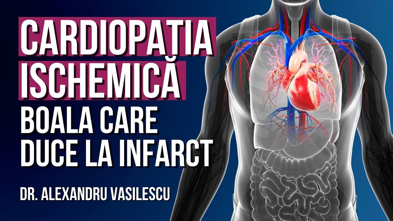 Boala care duce la INFARCT - Cardiopatia ischemică | dr. Alexandru Vasilescu