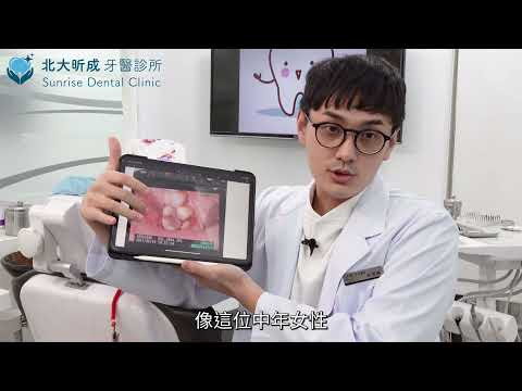 3D齒雕容易脫落嗎？封明翰牙醫師告訴您｜北大牙醫推薦/北大昕成牙醫/陶瓷貼片/前牙美學/全瓷冠/封明翰牙醫師/3D齒雕