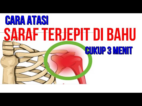 Video: Cara Menghilangkan Kulit: 6 Langkah (dengan Gambar)