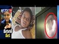 Doctors Remove Whistle From Boy's Lungs