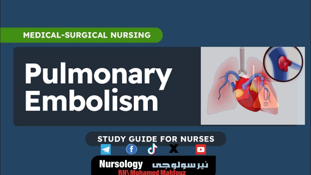 Pulmonary embolism