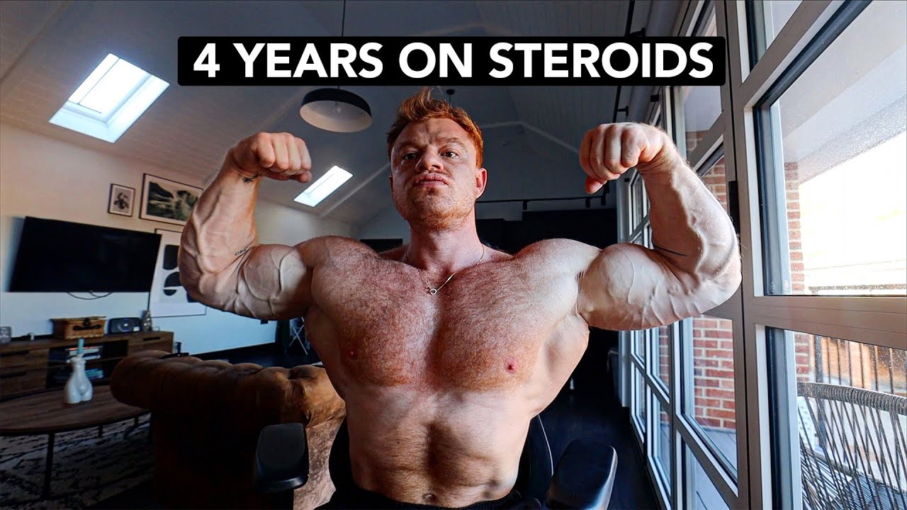 Blood work After Using Steroids For 4 Years YouTube Blood work After Using Steroids For 4 Years YouTube