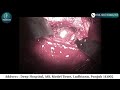Live Neurosurgery Procedure: Mesial Temporal Epidermoid Tumor |  neurosurgeon in punjab