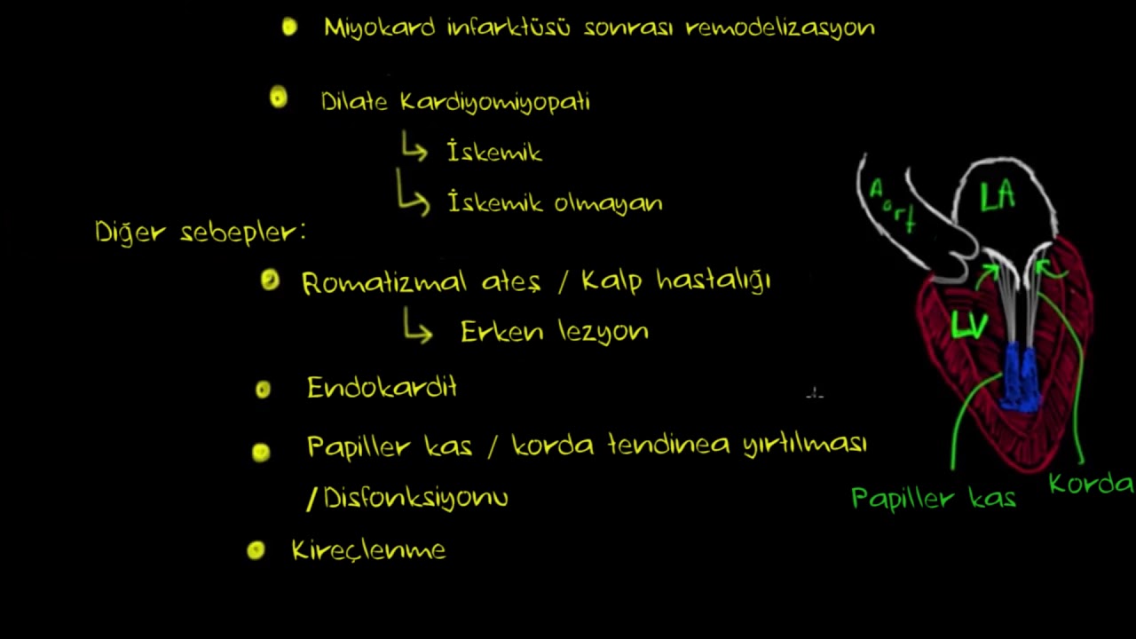 Mitral Kapak Regürjitasyonu ve Mitral Kapak Prolapsusu (Fen Bilimleri) (Sağlık ve Tıp)
