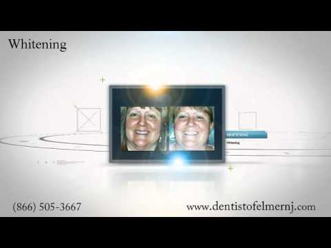 Dr. Bagley - Dentist of Elmer NJ - Before & Afters...