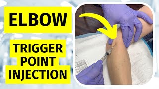 Tennis Elbow Trigger Point Injection