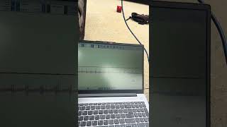 Relative compression test and pressure transducer in coolant to determine head gasket failure