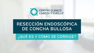 Concha Bullosa -  ¿Qué es y cómo se corrige?