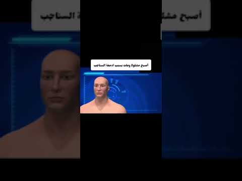 اسوء الطرق التي مات بها الناس