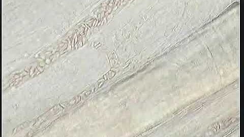 Red Blood Cells Flowing in vivo