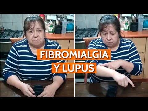 "No hay excusa para salir adelante" | FIBROMIALGIA Y LUPUS