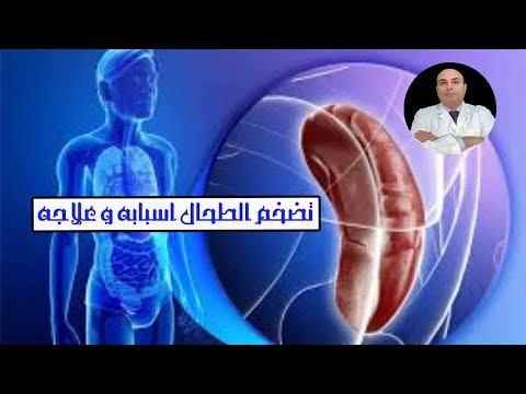 فيديو: لماذا يتورم الطحال؟