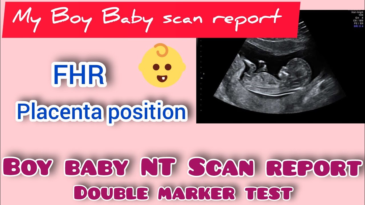 Boy Baby NT Scan Full Report Importance Of NT Scan Report And boy-baby-nt-scan-full-report-importance-of-nt-scan-report-and