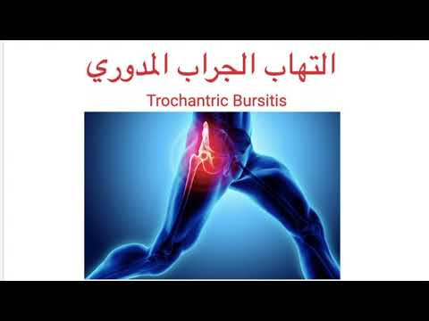 التهاب الجراب المدوري و علاجه