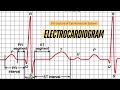 Ecg electrocardiogram easy interpretations by dr krunal dabhi