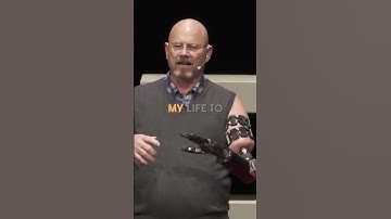 This is AWESOME! #prosthetics #robotichand #robotichand #robotics #prosthetichand #prostheticlimb