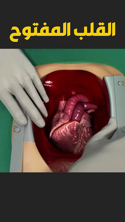 عملية القلب المفتوح سبحان الله علم الانسان ما لم يعلم #اكسبلور #قصص #ترند #قصص_واقعية #shorts