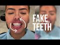We're Addicted To Lip Filler | HOOKED ON THE LOOK