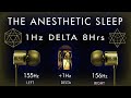 The anesthetic sleep   1hz delta brain hemisphere synchronization