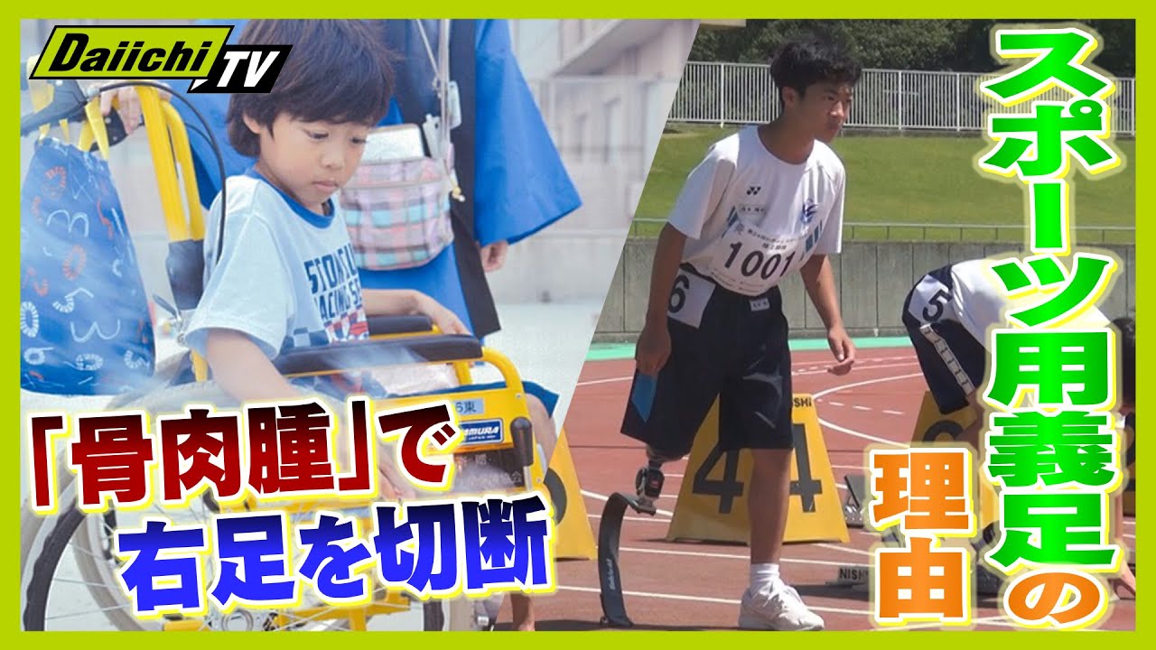 【義足の翔梧くん】小学生で右足を切断「友達が走ったらついて行きたい」日常を変えた スポーツ競技用の義足とは【every.しずおか特集】