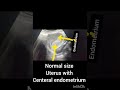 Ultrasound Pelvis showing uterus with centeral endometrium! Pelvic Scan!#ultrasoundmadeeasy86#viral