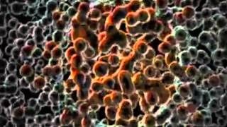 Docuemental Leucemia