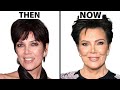 Kris jenners new face  plastic surgery analysis