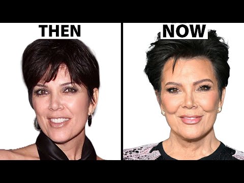 Kris Jenner's NEW FACE | Plastic Surgery Analysis