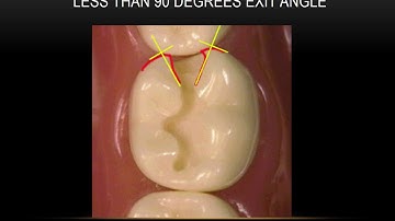 Composite Preps for Board Exams - #28 DO and #30 MO - Joel N. Janis, DDS