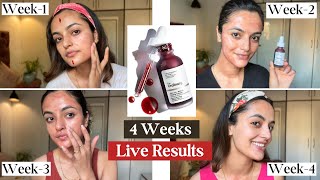 I tried The Ordinary Peeling Solution || 4 Weeks Live Results || Garima Verma ||