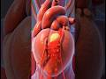 Angioplasty Explained in 20 Seconds #youtubeshorts #trending #viral #baby #usa