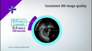The AVVIGO™ Multi Guidance System: System Overview