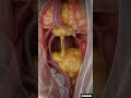 Sinusitis The Bad