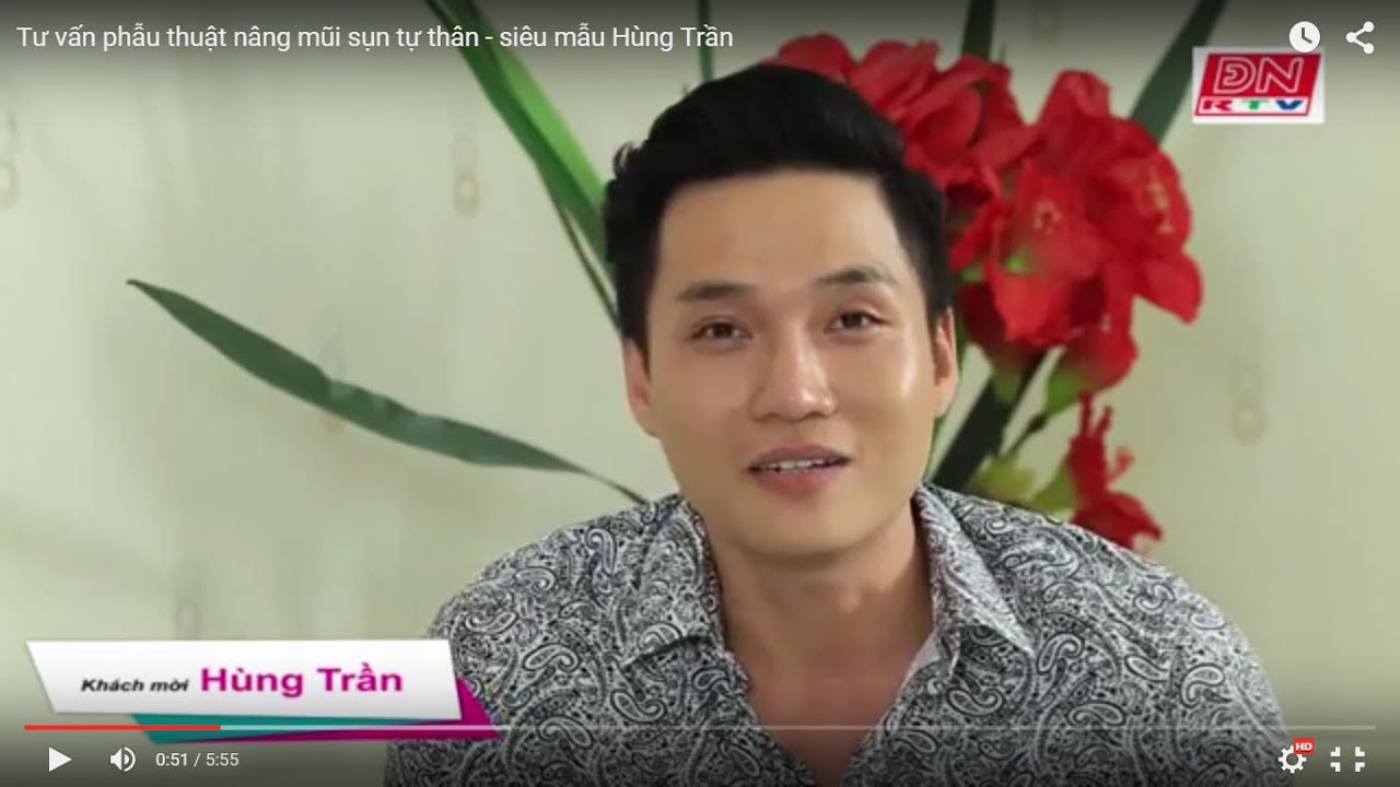 Tư vấn phẫu thuật nâng mũi sụn tự thân - siêu mẫu Hùng Trần