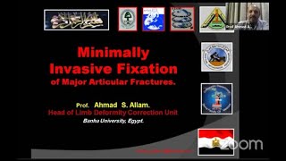 Minimally Invasive Fixation of Major Articular Fractures ( Prof. Ahmad S. Allam ) screenshot 5