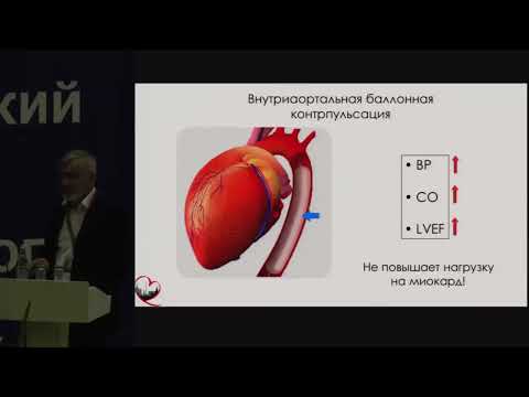Шок при остром