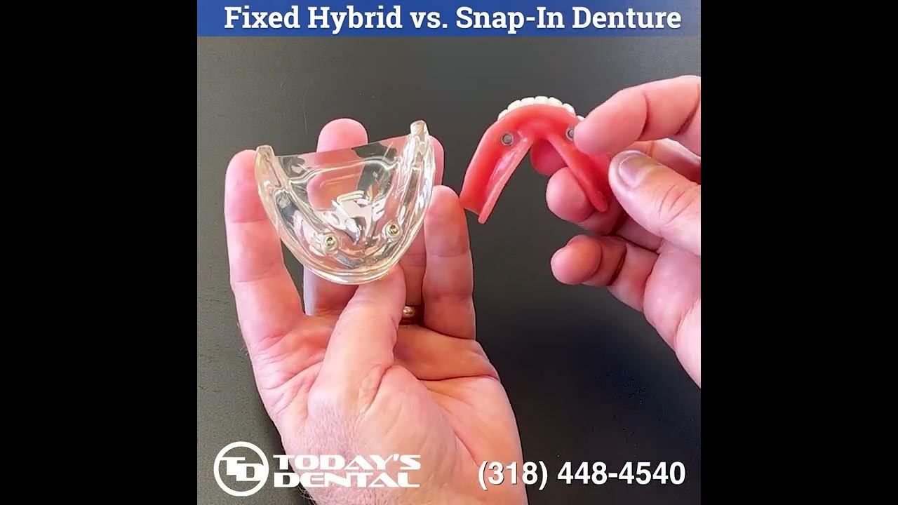 Permanent Dentures vs Snapin Dentures The Difference explained by Dr