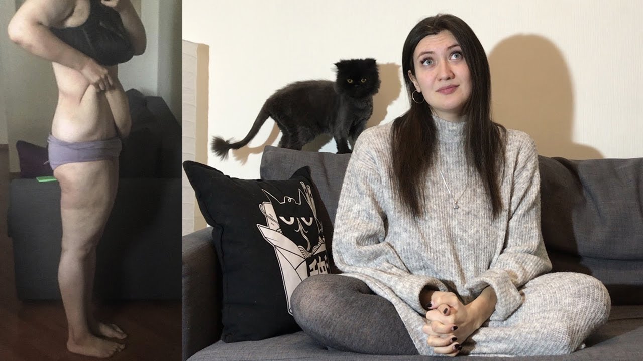 ЧТО СТАЛО С МОЕЙ КОЖЕЙ ПОСЛЕ ПОХУДЕНИЯ?