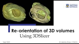Tutorial: Re-orientation of 3D volumes in 3DSlicer by Dr Jeremy Shaw