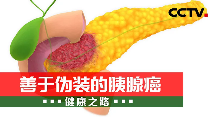 善于伪装的胰腺癌：专家做客现场教您如何识破狡猾的胰腺癌 20220630 |《健康之路》CCTV科教 - 天天要闻