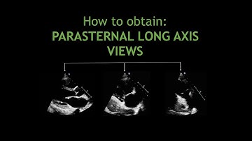 How to obtain: PARASTERNAL LONG AXIS VIEWS!