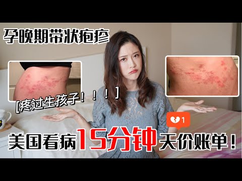 孕期最痛苦的经历//孕期得带状疱疹，在美国天价就医！